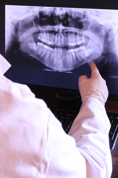 Best Emergency Root Canal Treatment in Whitwell, TN